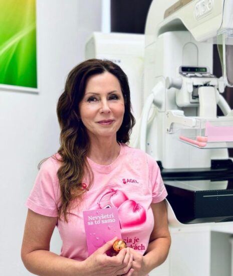 Ženy od mamografie odrádzajú hoaxy, lekári zdôrazňujú jej význam pre včasnú diagnostiku_69cceefababf9.jpeg